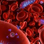 Her 5 ölü için 1: Sepsi! Kan zehirlenmesi nedir?