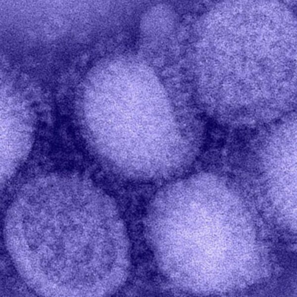 Kuzey Yarımküre’de “H3N2” alarmı! “Eşi görülmemiş grip vakaları yaşanıyor”